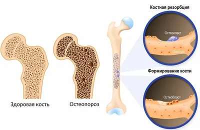 Серия постов «Анатомия. Кости.»