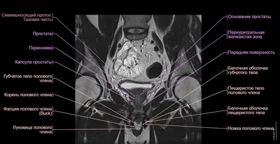 Нормальная анатомия мужского таза | Ассоциация врачей МРТ и КТ