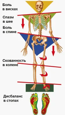 Энциклопедия - Тазовый пояс