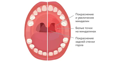 Кашель и болезни у ребенка | Гербион