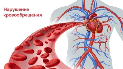 Нарушение кровообращения. Виды, симптомы, лечение - ТрэндМедика