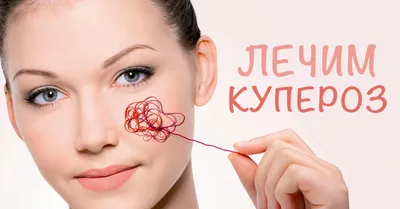 Купероз на лице. | Советы дерматолога|Sovetydermatologa | Дзен