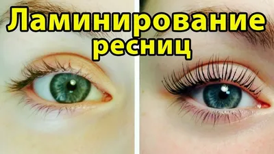 Ламинирование ресниц: фотографии, доказывающие эффективность процедуры