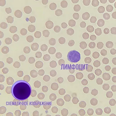 Что такое лейкоциты. Их функции ForPost - Здоровье |