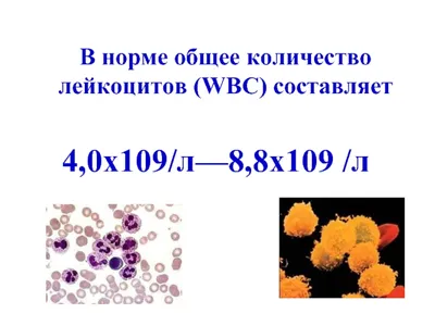 Как понизить лейкоциты в крови и почему их уровень повышается