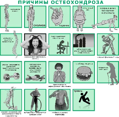 УПРАЖНЕНИЯ ПРОТИВ ОСТЕОХОНДРОЗА | Пикабу