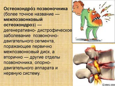 Гимнастика при остеохондрозе грудного отдела | Блог о здоровье