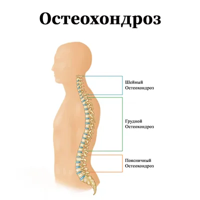 Плавание при остеохондрозе | Клиника доктора Шишонина