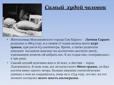 Самый худой человек — в мире, сколько весил, фото, Лючия Сарате, в России -  24СМИ