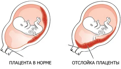 Как себя подготовить к родам: морально и физически