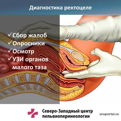 Этапы родов: предвестники, схватки, открытие шейки матки.