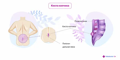 Масло для тела WELEDA (Веледа) для профилактики разрывов во время родов 50  мл (5550000387809) Weleda (Германия) - Купить WELEDA по низкой цене в  Украине - МИС Аптека 9-1-1