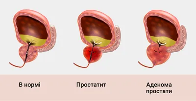 Массаж промежности перед родами значительно снижает риск разрывов (18+) |  Для взрослых | WB Guru