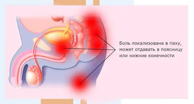 Самостоятельный массаж простаты. Как правильно делать руками, массажёром,  купить книгу на MagicBook - BK/43474156/R