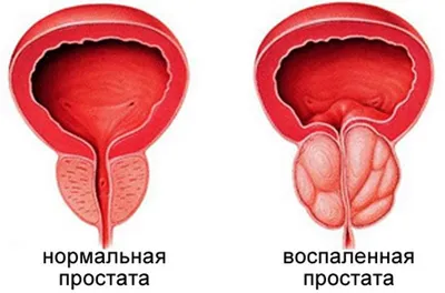 Массаж простаты в картинках фотографии