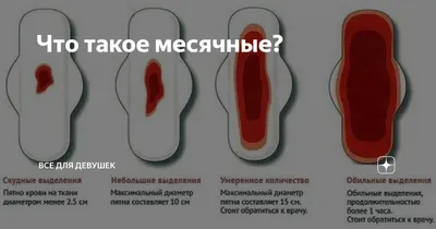 Отсутствие месячных — это бесплодие? Аменорея.