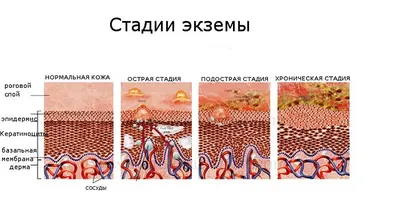 Мокнущая экзема - Страница 22 - Кожные заболевания, аллергия, уши, глаза,  подушечки лап - Лабрадор.ру собаки - ретриверы