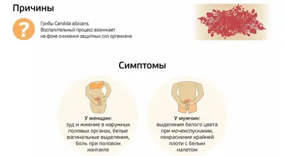 Что такое молочница: почему так часто ей болеют женщины и что с этим делать  | О здоровье: с медицинского на русский | Дзен