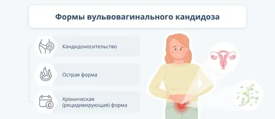 Молочница или вульвовагинальный кандидоз. Симптомы и лечение