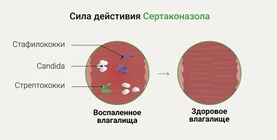 Что такое молочница: почему так часто ей болеют женщины и что с этим делать  | О здоровье: с медицинского на русский | Дзен