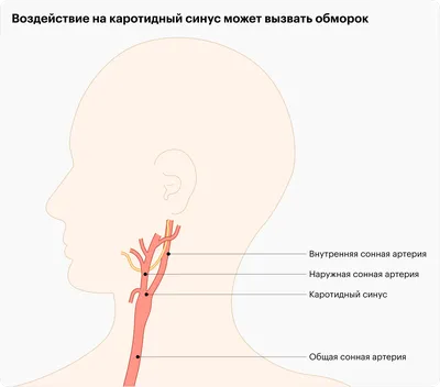 обморок и симптом болезни иллюстрация вектора. иллюстрации насчитывающей  работа - 226295684