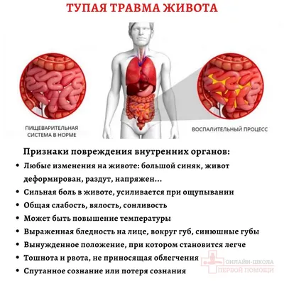 УЗИ органов брюшной полости (печень, желчный пузырь, поджелудочная железа,  селезнка)