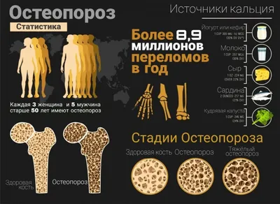 Безмолвная эпидемия. Что такое остеопороз, чем он опасен и как его лечить