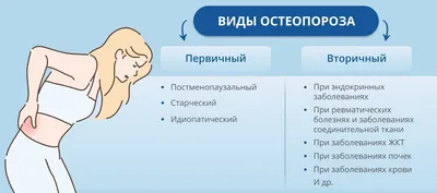 Остеопороз: симптомы и профилактика, лечение остеопороза у женщин и мужчин  в Москве