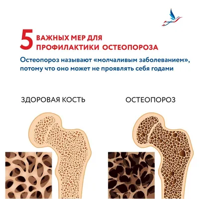 Лечение остеопороза в Одессе - оздоровительный центр Евминов–Кудряшова