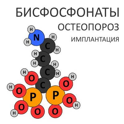 Остеопороз – причины и факторы риска, симптомы, диагностика, лечение,  профилактика