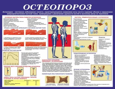 Остеопороз — РОССИЙСКАЯ АССОЦИАЦИЯ ХИРУРГОВ-ВЕРТЕБРОЛОГОВ