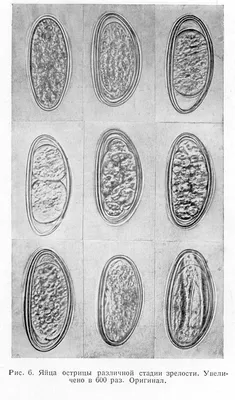 Острицы — стоковые фотографии и другие картинки Pinworm - Pinworm, Червь,  Ободочная кишка - iStock