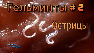 Своим даю только ЕГО: раз в полгода «гоним» паразитов! Глисты, острицы, ...  | Здоровый образ жизни, Здоровье, Здоровый