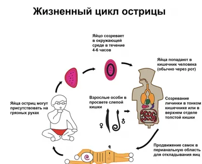 Паразитарные заболевания. Острицы - кто это? | ИзучаюМир | Дзен