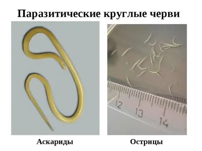 Утром в трусах шевелился ком паразитов! Касторка от паразитов (глисты,  острицы и даже... - YouTube | Домашнее лечение, Здоровье, Женское здоровье