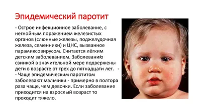 Чем опасен паротит? - Эпидемиологический надзор - Управление Федеральной  службы по надзору в сфере защиты прав потребителей и благополучия человека  по городу Санкт-Петербургу