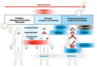 Паротит