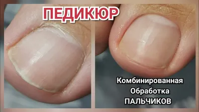 Безупречный педикюр без гель-лака