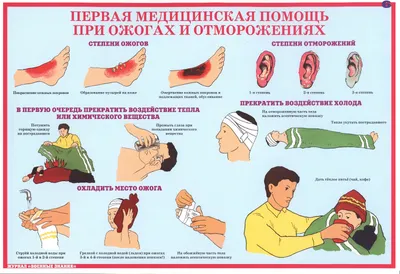 Купить Комплект плакатов Первая медицинская помощь, 11 листов |  Интернет-магазин Сити Бланк