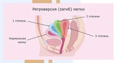 Тесты на беременность Evitest - «🔘Тест на беременность Evitest. Какие  первые признаки беременности. В какое время суток лучше делать тест на  беременность. » | отзывы