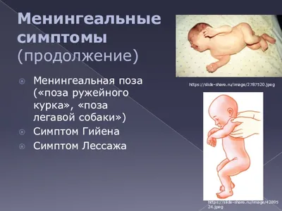 Веймарская Легавая В Его Типичные Поза — стоковые фотографии и другие  картинки Собака - Собака, Стоять, Хвост - iStock