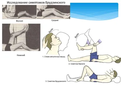 Инфекционные заболевания нервной системы - online presentation