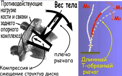 Менингит - online presentation