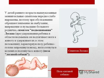 Прививки и последствия — 96 ответов | форум Babyblog