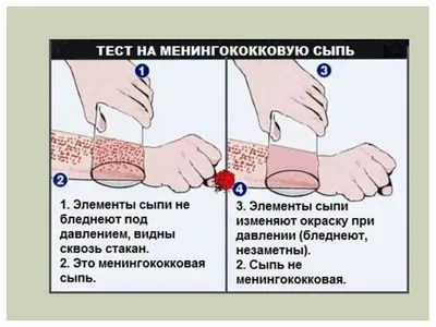 Презентация на тему: \"Оболочки головного мозга, ликвор. Менингеальный  синдром и ликворногипертензионный синдромы. Люмбальная пункция. Подготовила  студентка 4-го курса 1-го медицинского.\". Скачать бесплатно и без  регистрации.