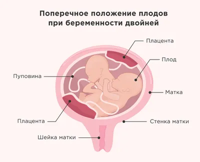 Лучшие позы для зачатия ребенка | женские советы | Дзен