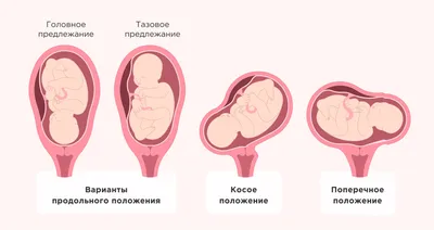 5 упражнений от боли в спине во время беременности – Академический  медицинский центр (AMC) - медицинская клиника в самом центре Киева