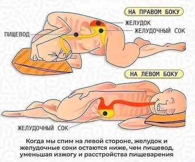 Как выбор позы для сна может влиять на риск онкологии: на каком боку лучше  спать, чтобы избежать неприятных симптомов | REHAB.YOU | Дзен