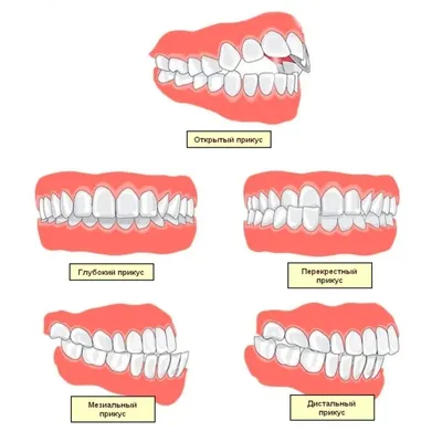 Неправильный прикус у собаки: что делать? | Мировая прокрастинация. | Дзен
