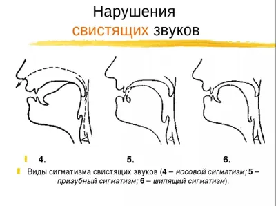 Презентация на тему: \"ЗВУКОПРОИЗНОШЕНИЕ НОРМА и НАРУШЕНИЯ. Профиль органов  артикуляции.\". Скачать бесплатно и без регистрации.